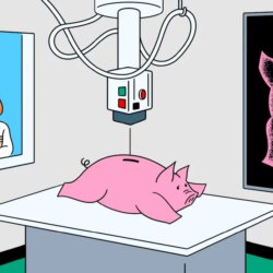 Comment vérifier vos frais 401(k)